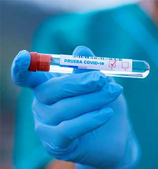 Tubo de muestra para examen médico